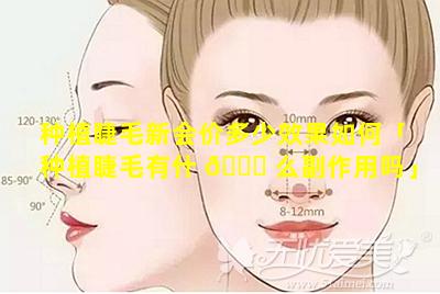 种植睫毛新会价多少效果如何「种植睫毛有什 🐞 么副作用吗」